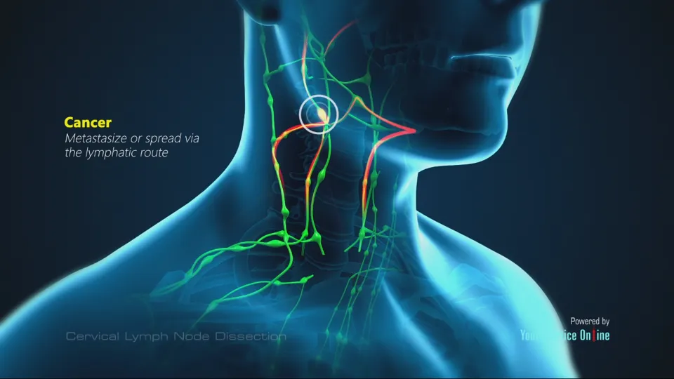 Label the Lymph Node-know Your Own Body
