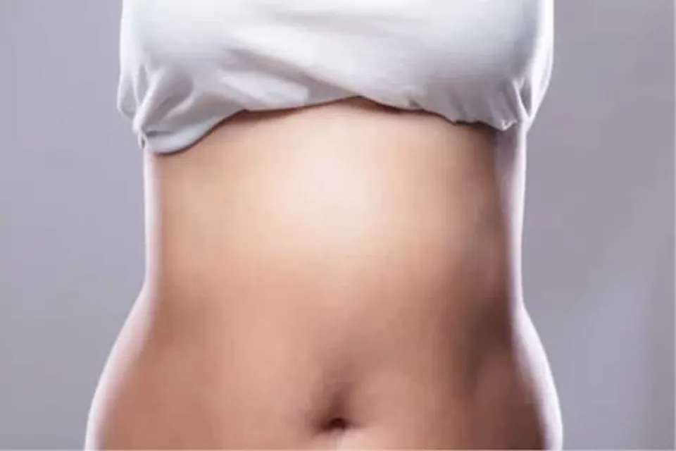 Lower Belly Pooch: Causes&how to Lose It